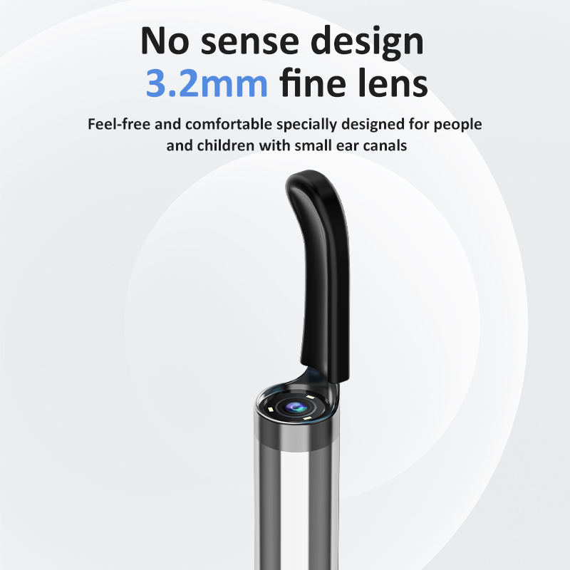 SUNUO Q8 Otoscopio per rimozio - Lighting Visual recensione e prezzo